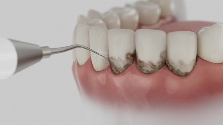 Reliable Teeth Cleaning And Checkup contractor in Coosa County County, AL by Dentist Open Now